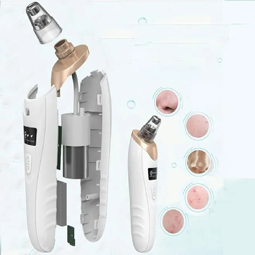 5-in-1 Electric Blackhead Remover – Deep Pore Vacuum & Acne Cleaner