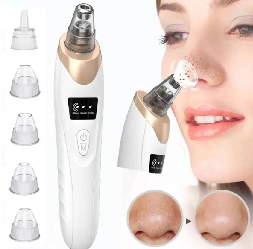 5-in-1 Electric Blackhead Remover – Deep Pore Vacuum & Acne Cleaner